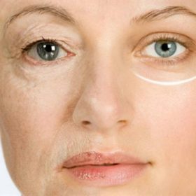 Vì Sao Làn Da Nhạy Cảm Cần Chống Oxy Hóa?