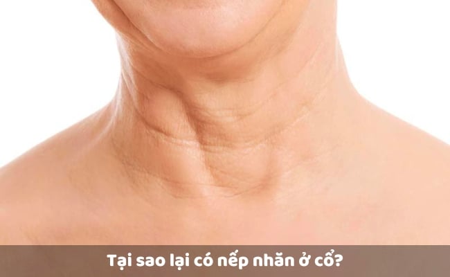 Mẹo Giảm Nếp Nhăn Vùng Cổ Đơn Giản